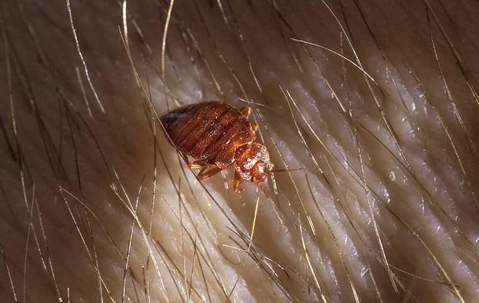 bed bug on skin