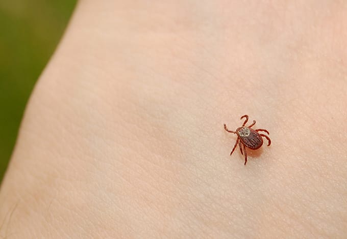 Tick on the skin