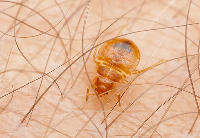 Bed bug on a hairy skin